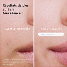 Lade das Bild in den Galerie-Viewer, Braun Épilateur À Lumière Pulsée Intelligent Skin i·expert PL7253, Épilation À Domicile, Alternative Au Laser, Avec Appli, Mini-Rasoir Visage, 3 Têtes Intelligentes Pour Épiler Jambes, Maillot, Plus

