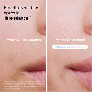 Braun Épilateur À Lumière Pulsée Intelligent Skin i·expert PL7253, Épilation À Domicile, Alternative Au Laser, Avec Appli, Mini-Rasoir Visage, 3 Têtes Intelligentes Pour Épiler Jambes, Maillot, Plus